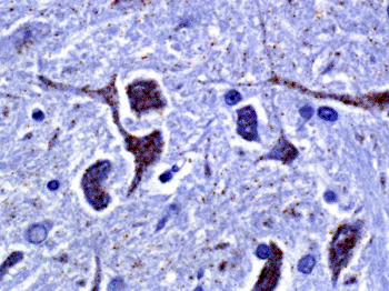 Image: mRNA of Nav1.7, a sodium ion channel, expressed in normal mouse brain tissue (Photo courtesy of Ventana Medical Systems).